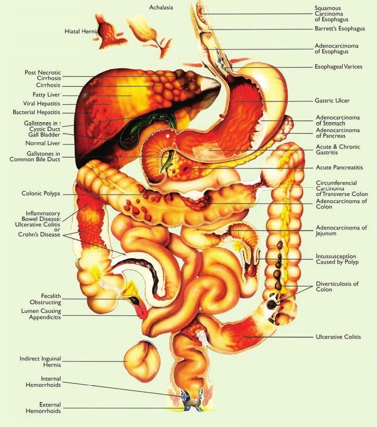 digestive-diseases-alida-deligeorges-the-gut-detective